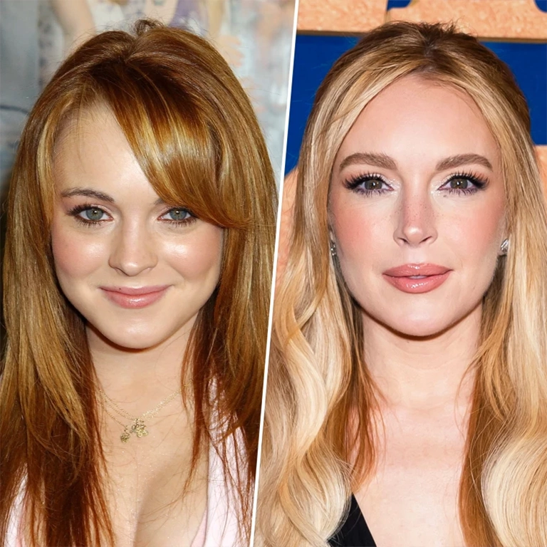 Lindsay Lohan Rhinoplasty Before and After