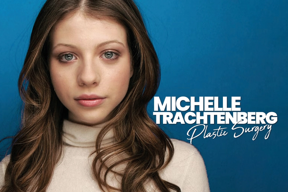 Michelle Trachtenberg Plastic Surgery