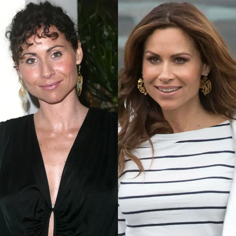 Minnie Driver Plastic Surgery Before and After