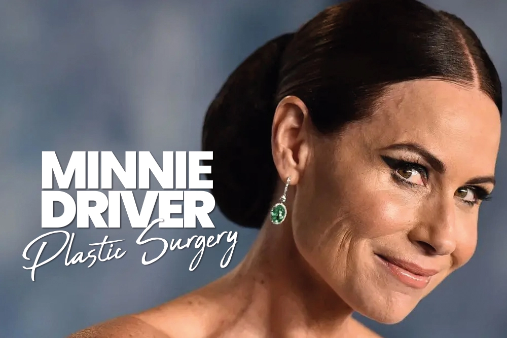 Minnie Driver Plastic Surgery