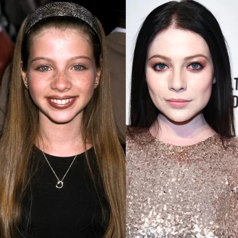 Plastic Surgery and Aging Gracefully