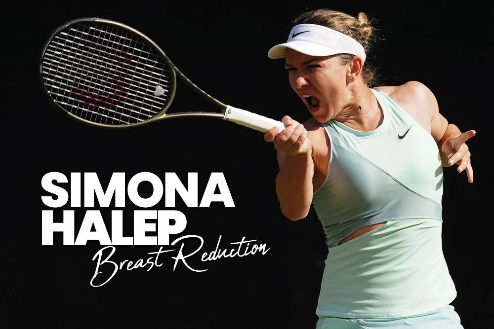 Simona Halep Breast Reduction