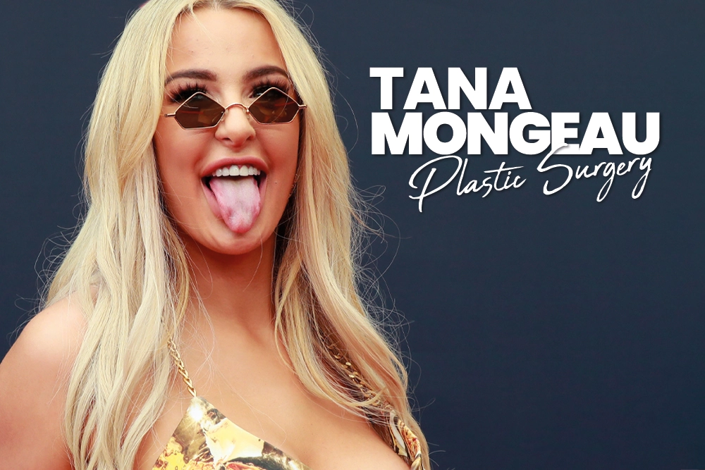Tana Mongeau Plastic Surgery