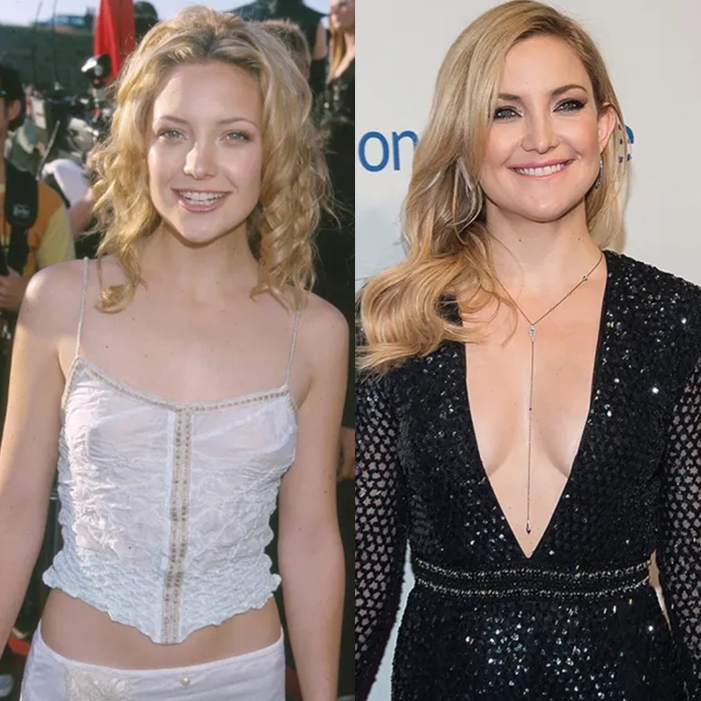 The Art of the Mini Boob Job Achieving a Natural Look