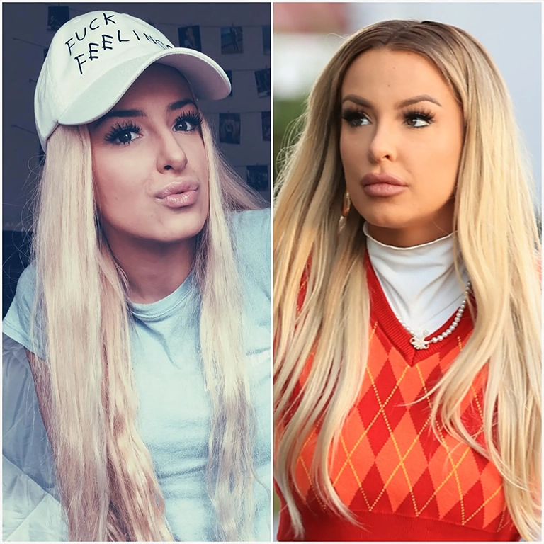 The Complete List of Tana Mongeau Plastic Surgery Procedures