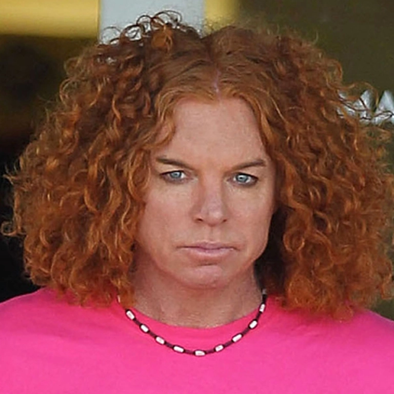 The Dangers of Extreme Plastic Surgery