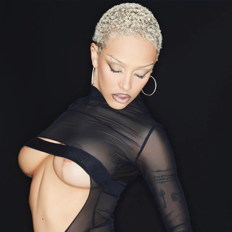 The Doja Cat Effect Why This Surgery is a Life-Changing Decision