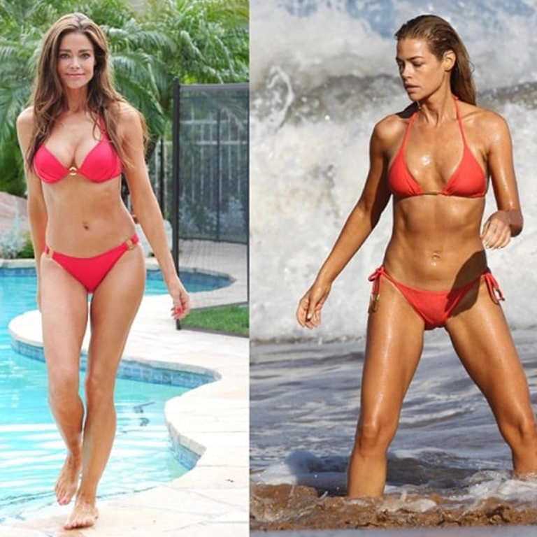 The Importance of Choosing the Right Implant Size and Type