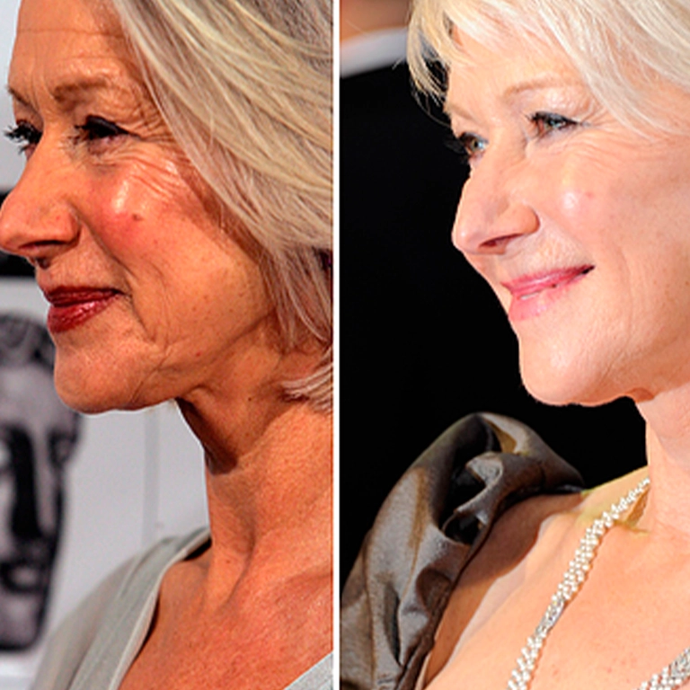 The Importance of Subtle Enhancements