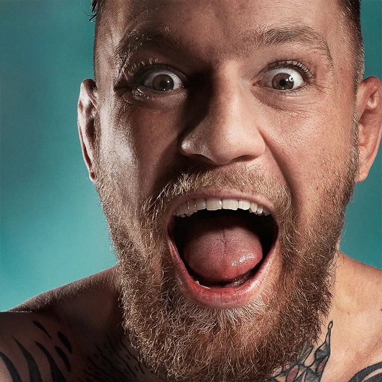 The Story Behind Conor McGregor's Smile