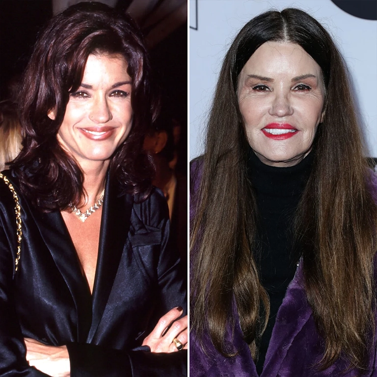 What Happened to Janice Dickinson's Face