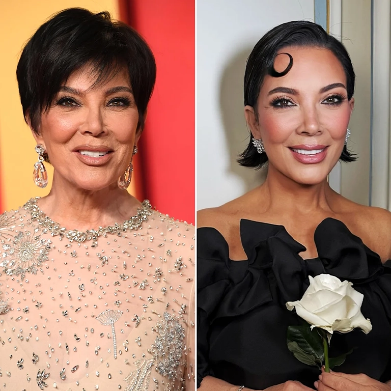 Why a Mini Facelift is a Popular Choice for Women Over 50