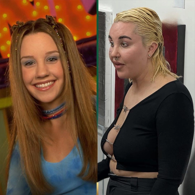 Amanda Bynes Before and After
