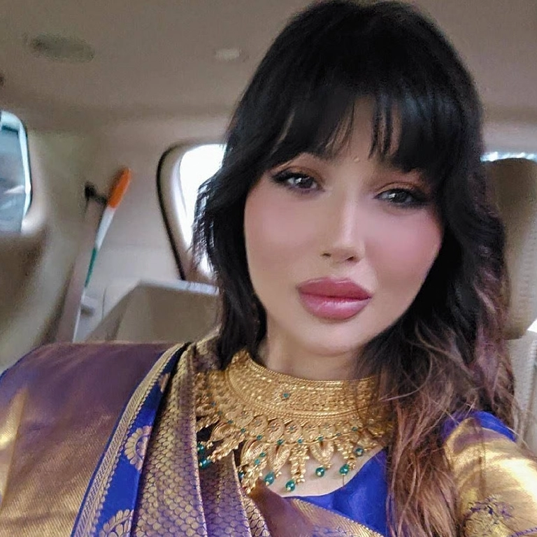 Ayesha Takia Botox and Fillers