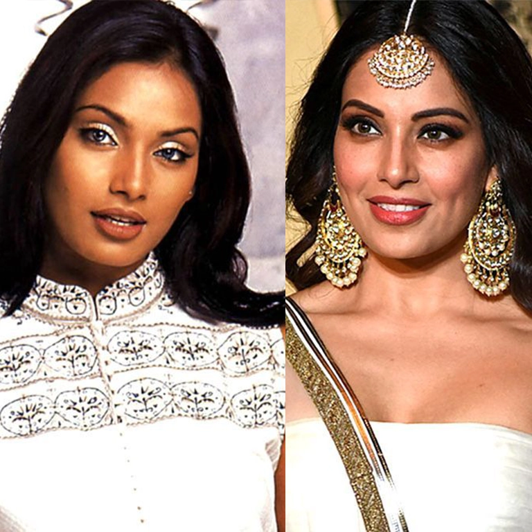 Bipasha Basu Botox and Fillers