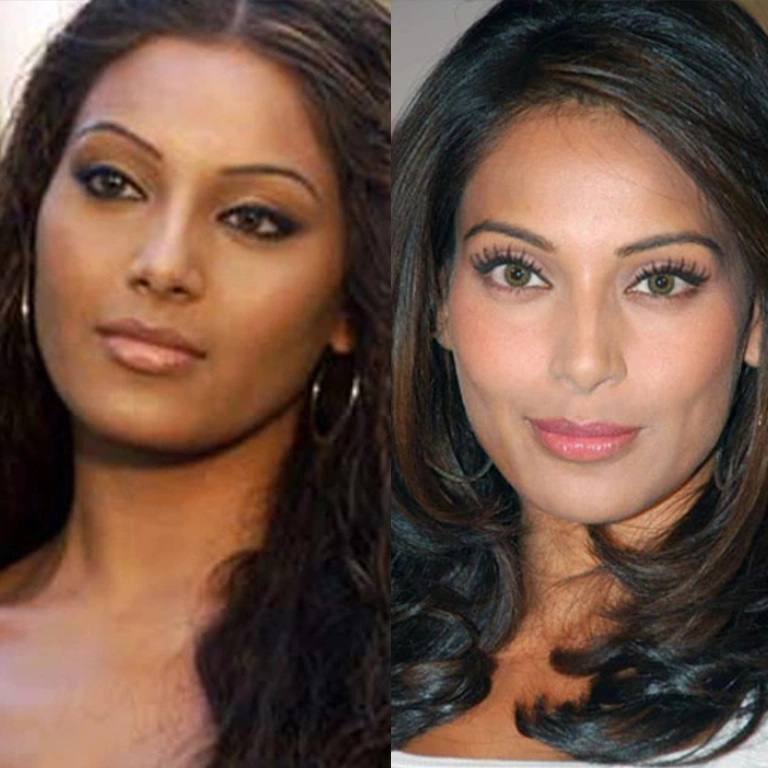 Bipasha Basu Surgery Rumors
