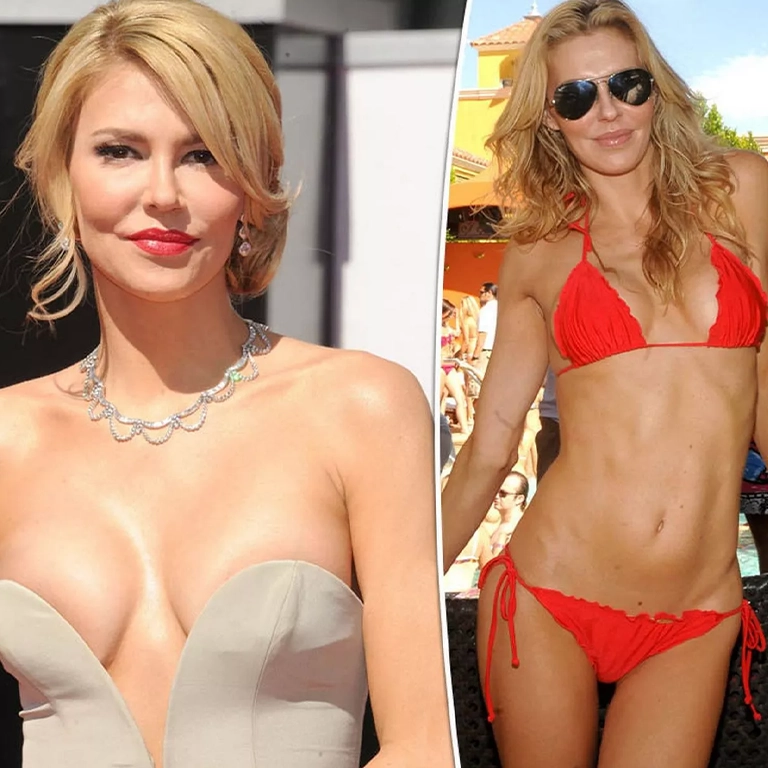 Brandi Glanville Implant Revision