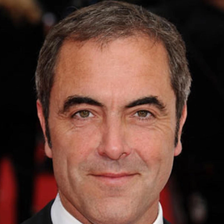 Celebrity Hair Transplant Results 2025