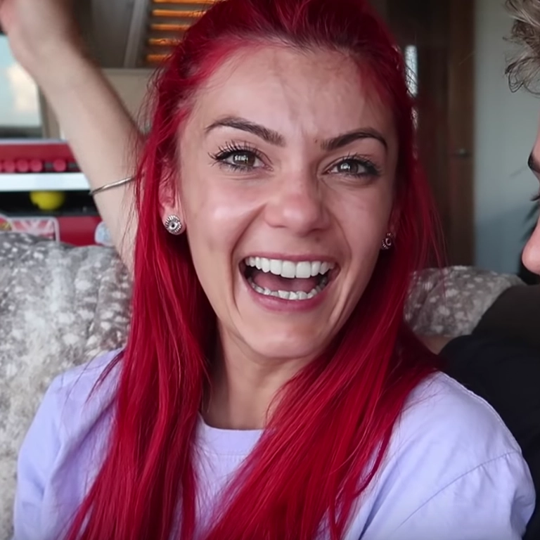 Dianne Buswell Teeth Transformation