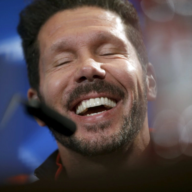 Diego Simeone Dental Work