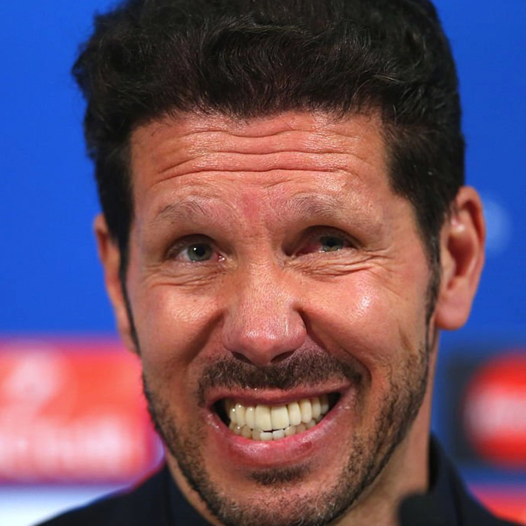 Diego Simeone Teeth Surgery