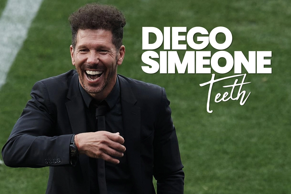 Diego Simeone Teeth