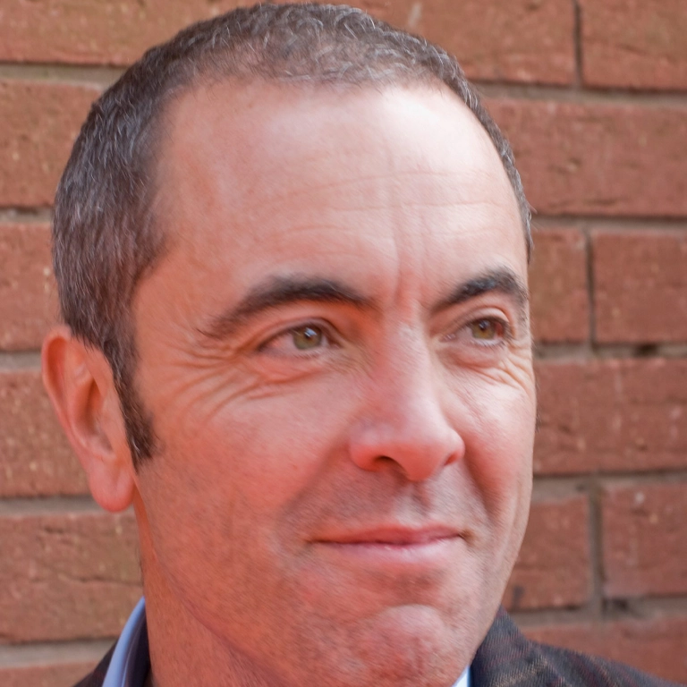 James Nesbitt Hair Transformation