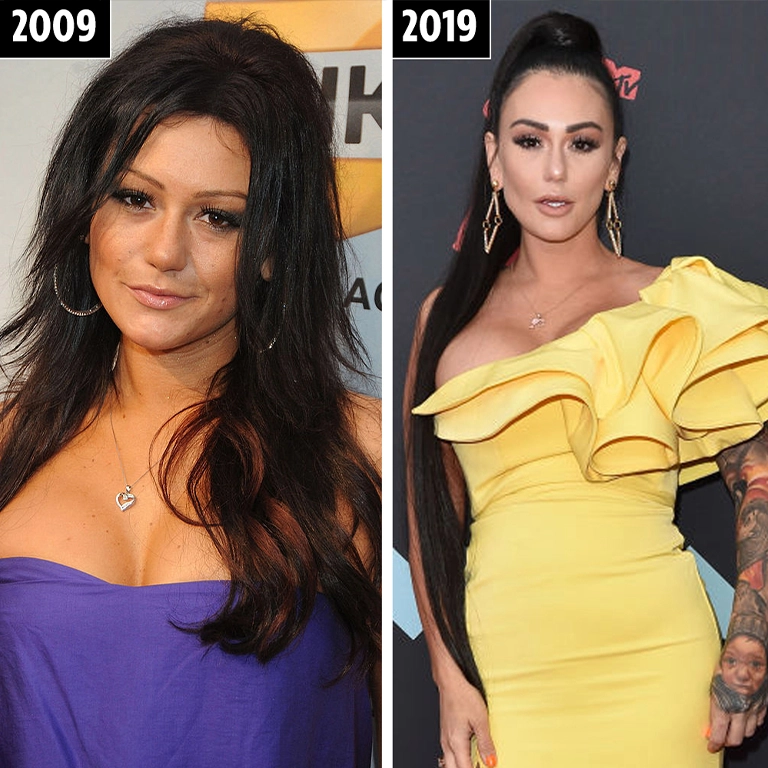 Jenni Farley Implant Revision