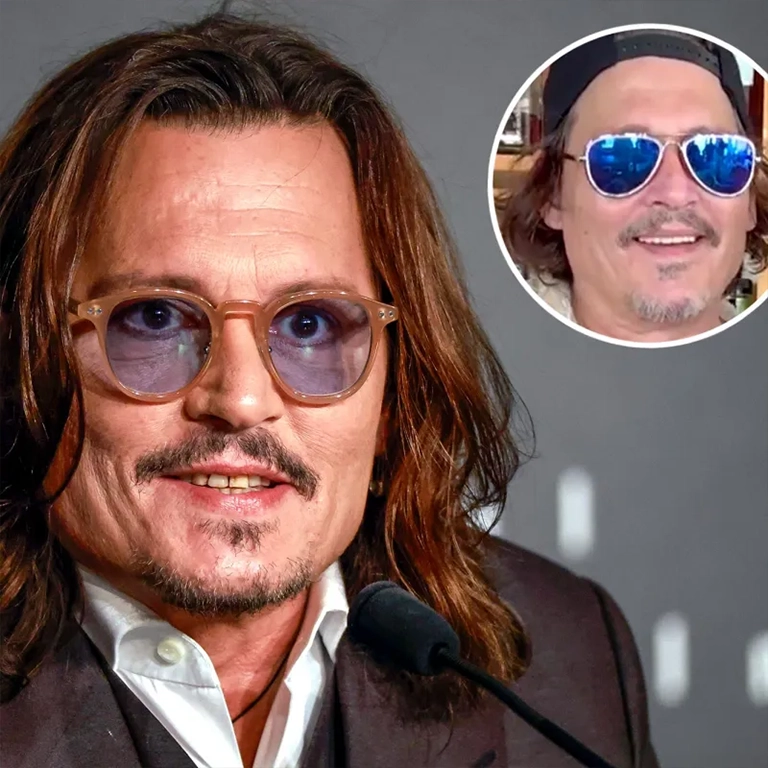 Johnny Depp Dental Work