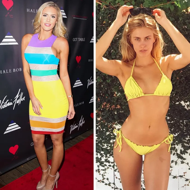 Kayla Rae Reid Breast Surgery