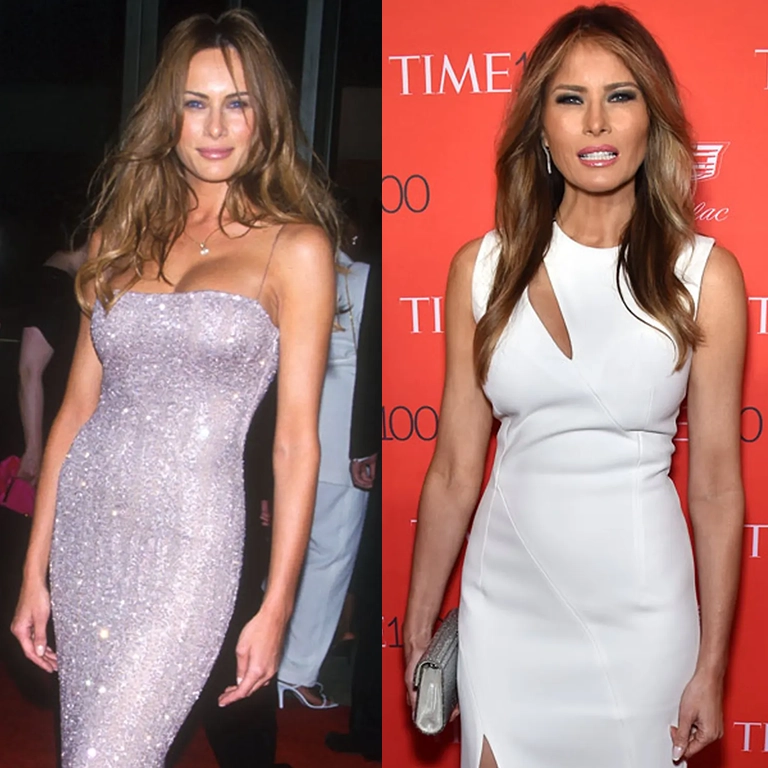 Melania Trump Before and After