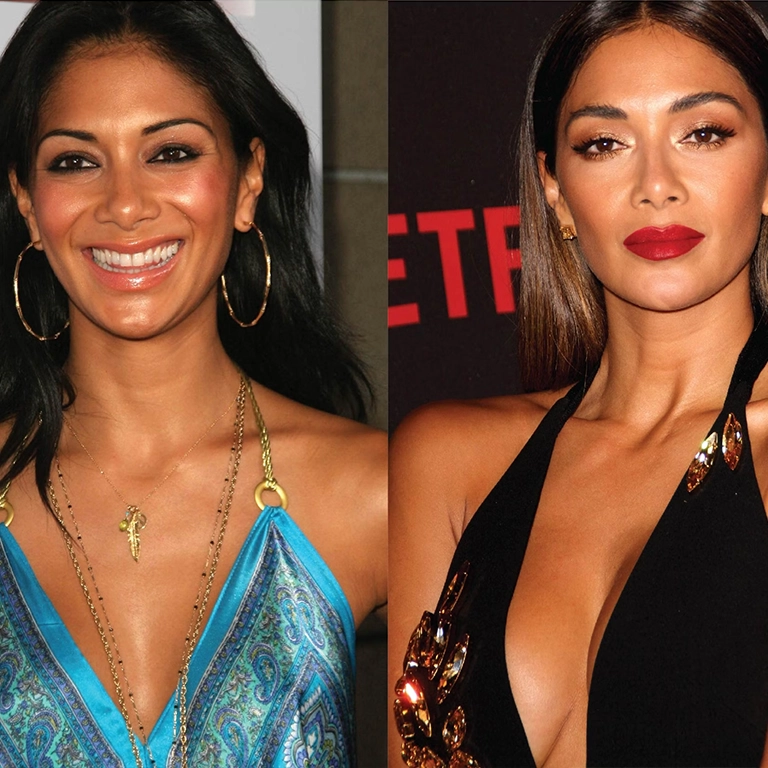 Nicole Scherzinger Breast Lift