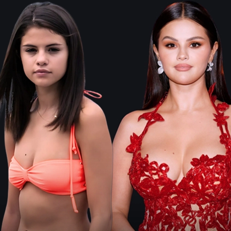 Selena Gomez Breast Surgery