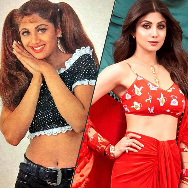 Shilpa Shetty Botox and Fillers