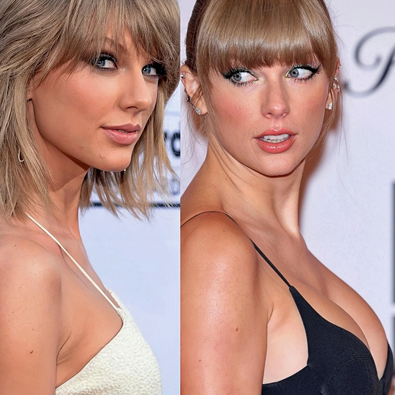 Taylor Swift Breast Surgery