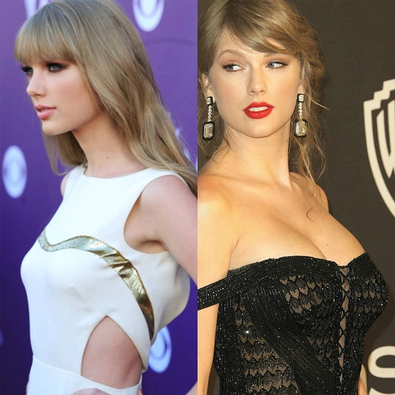Taylor Swift Breast Transformation