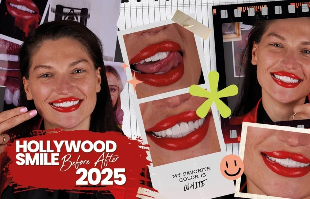The Ultimate Guide to a Hollywood Smile in 2025
