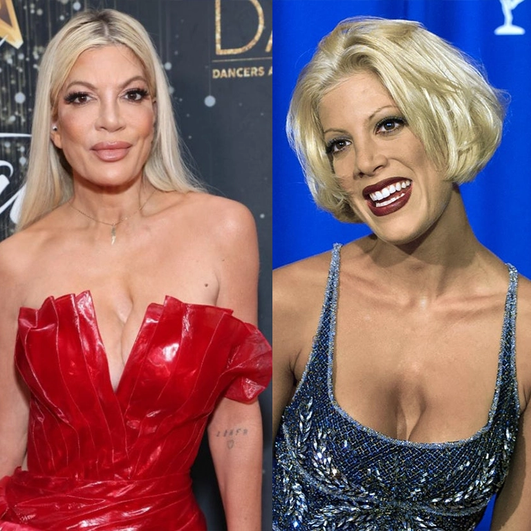 Tori Spelling Breast Surgery