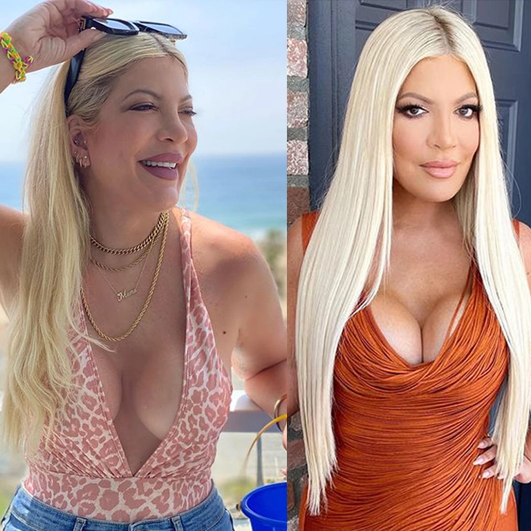 Tori Spelling Implant Revision