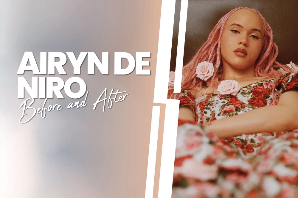 Airyn de Niro Before and After