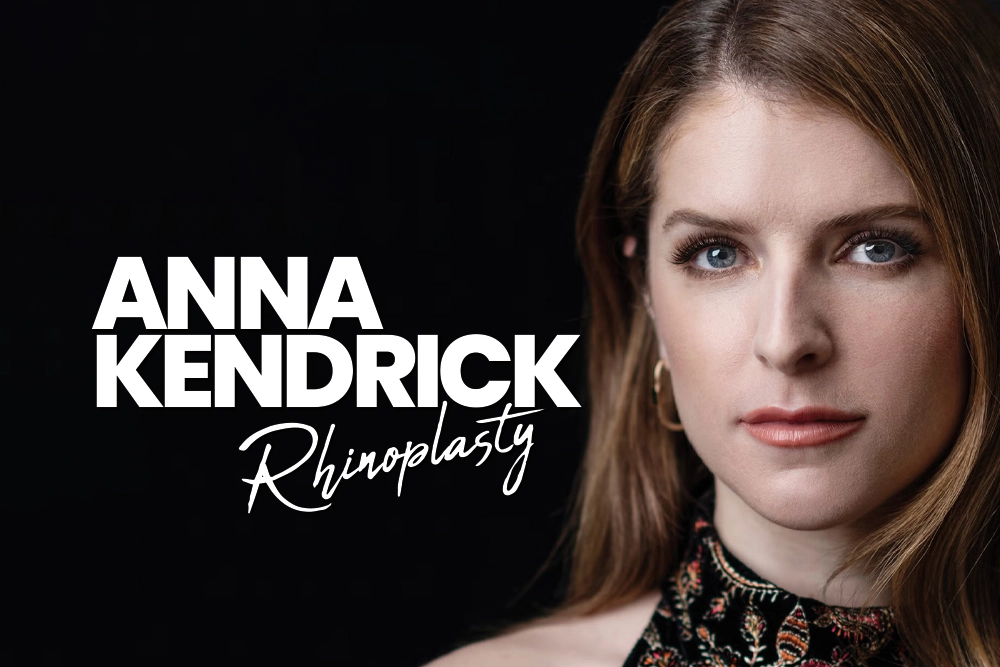 Anna Kendrick Rhinoplasty