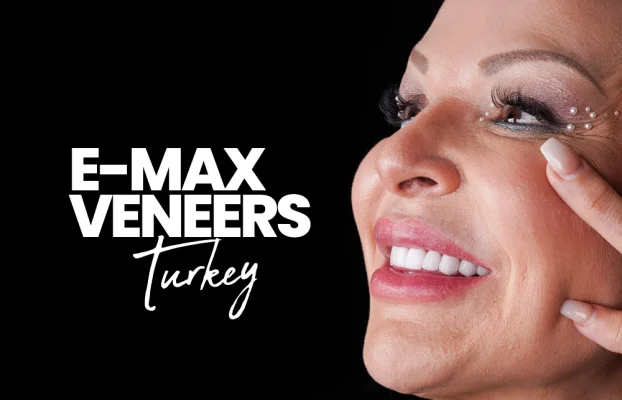 E-max Veneers Turkey