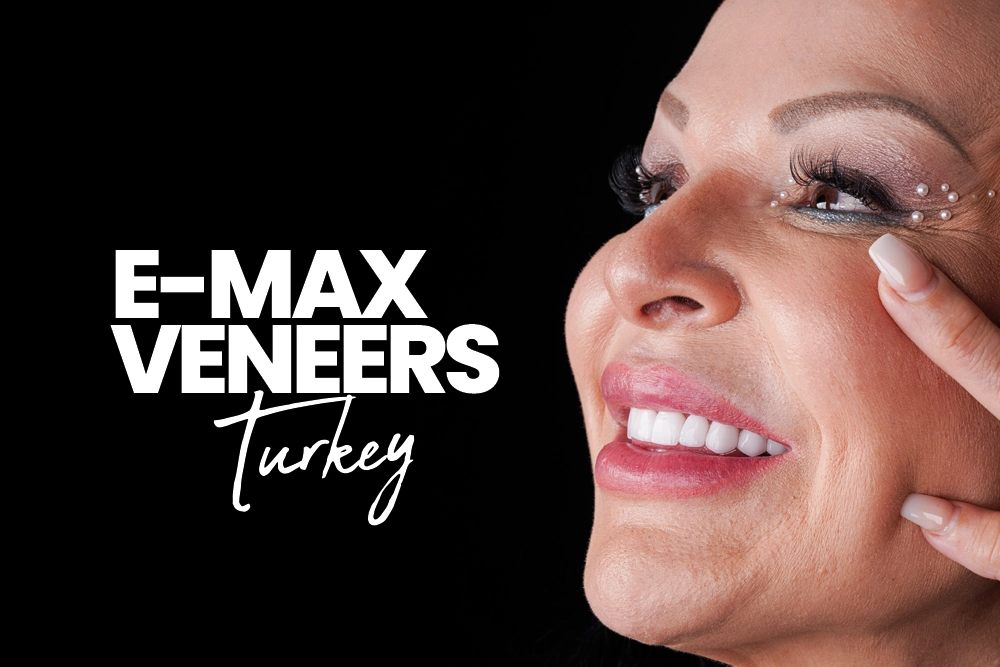 E-max Veneers Turkey
