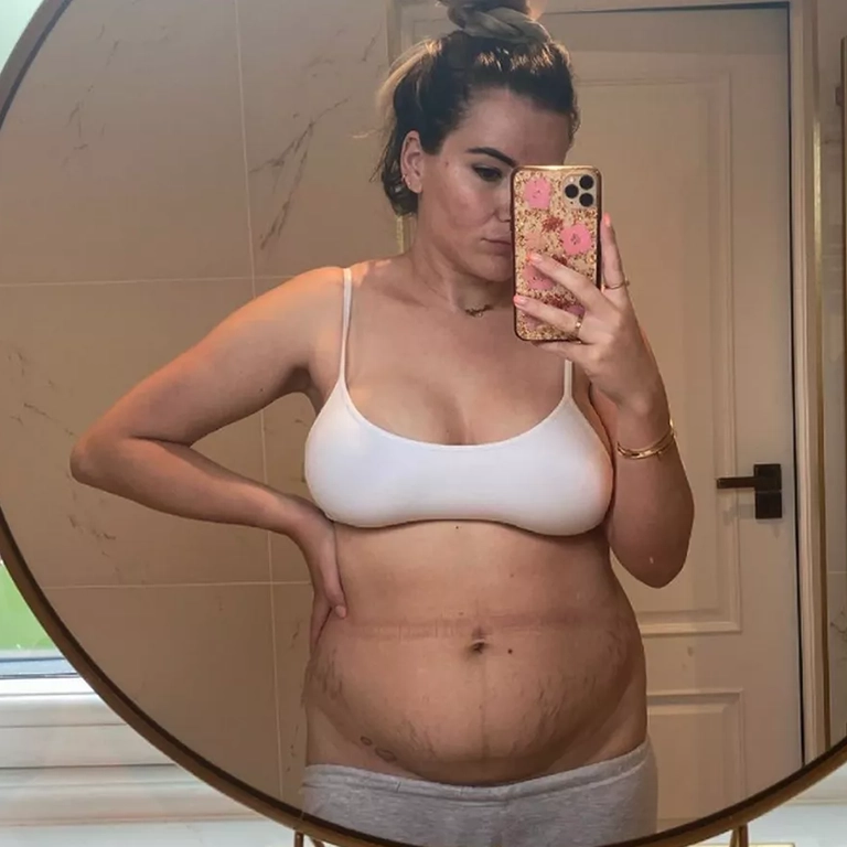 Georgia Kousoulou Before and After