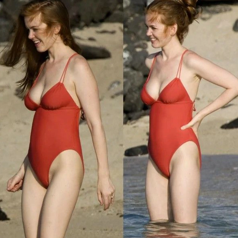 Isla Fisher Breast Surgery