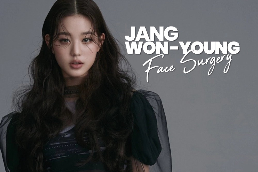 Jang Won-young Face Surgery