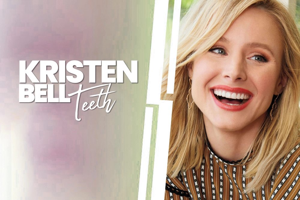 Kristen Bell Teeth