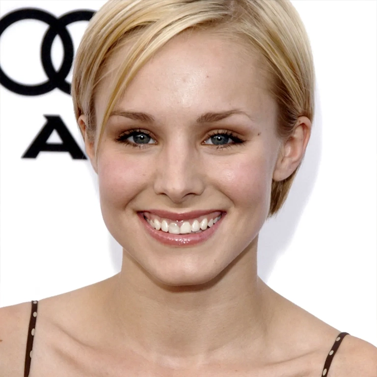 Kristen Bell Veneers
