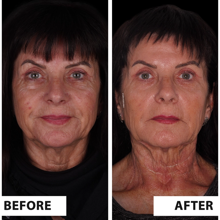 Medical Aesthetics Turkey 2025