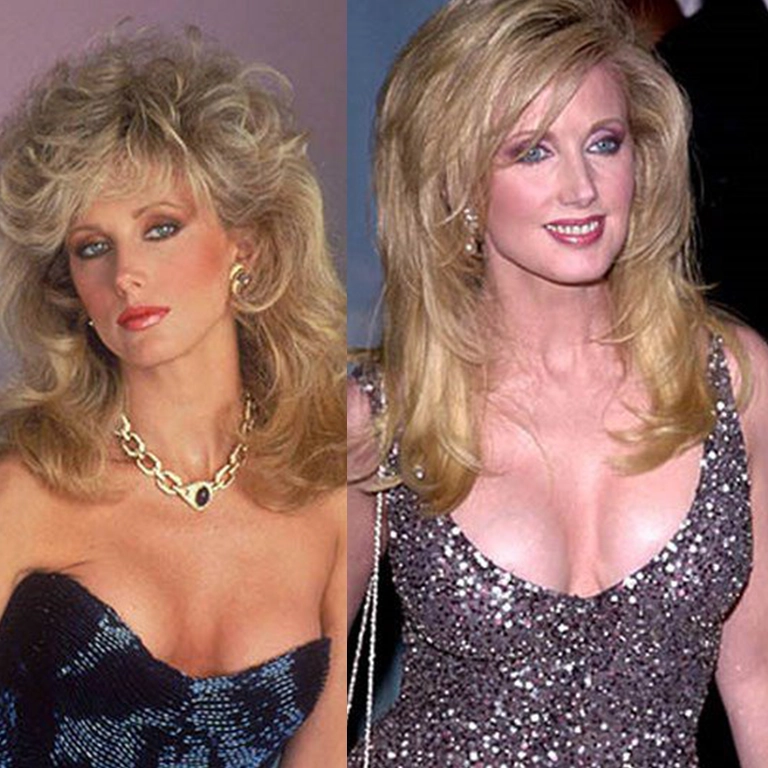 Morgan Fairchild Implant Revision